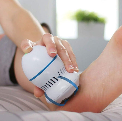 Dead Skin Callus Remover - Urban Mart